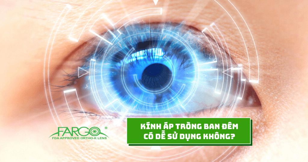 Nhược điểm của kính áp tròng ban đêm Ortho-K cần lưu ý không phải ai cũng biết